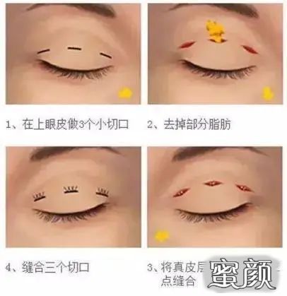 https://img.miyanlife.com/mnt/timg/210510/15223a1U-7.jpg