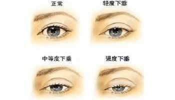 https://img.miyanlife.com/mnt/timg/210512/1309555A8-2.jpg