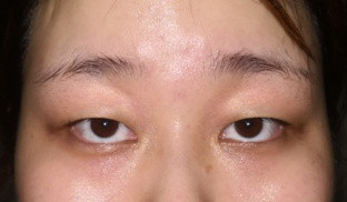 https://img.miyanlife.com/mnt/timg/210512/13095625Y-3.jpg