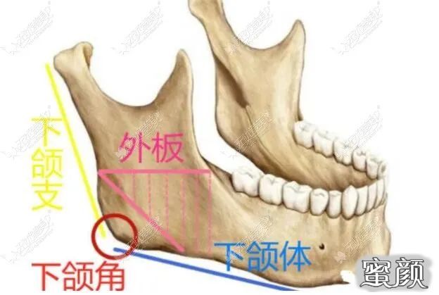 案例图片