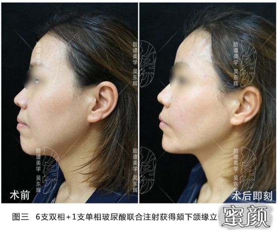 https://img.miyanlife.com/mnt/timg/210518/0I0192D7-4.jpg