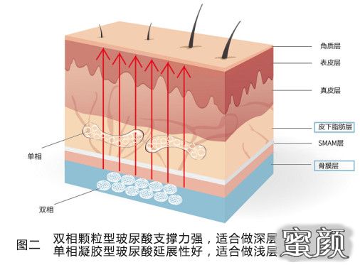 案例图片