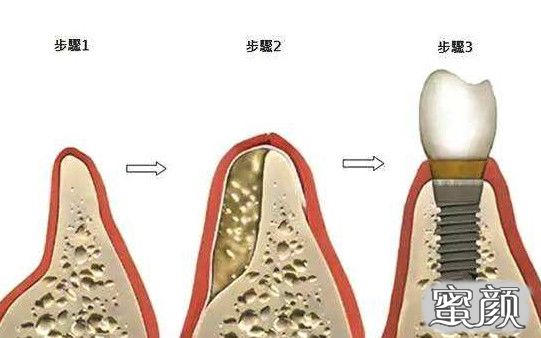 案例图片