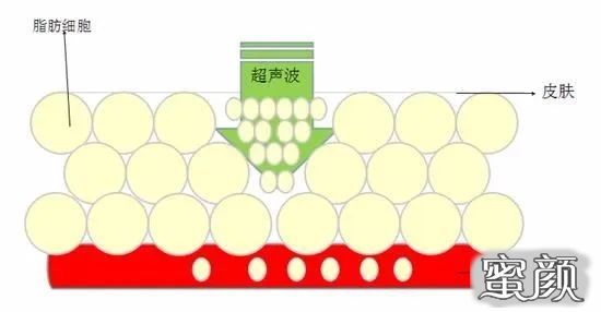 案例图片