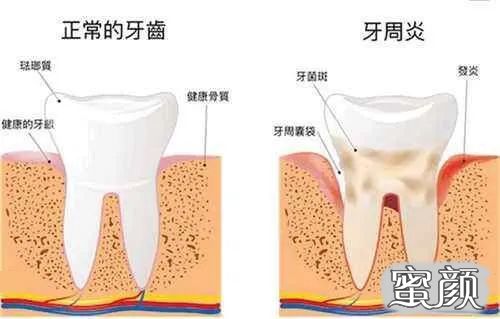 案例图片