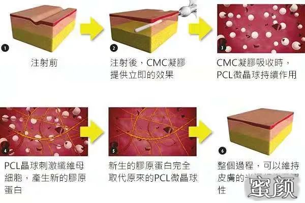 案例图片