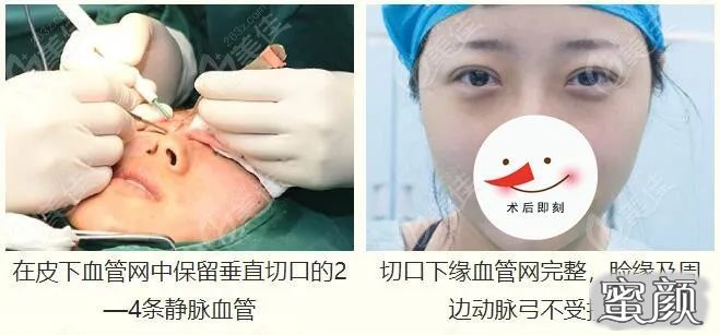 https://img.miyanlife.com/mnt/timg/210523/12103M2Q-1.jpg