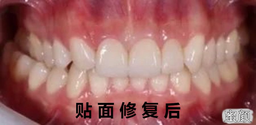 https://img.miyanlife.com/mnt/timg/210523/1246024S6-2.jpg