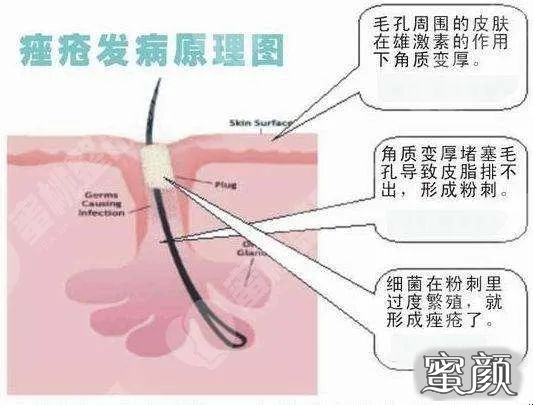 案例图片