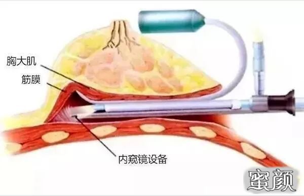 案例图片