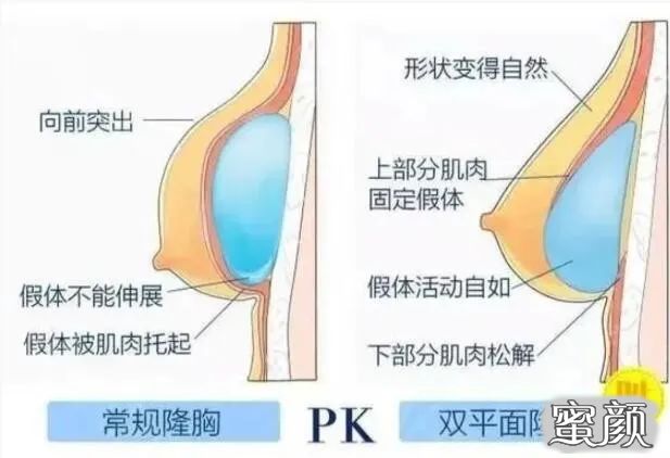 案例图片