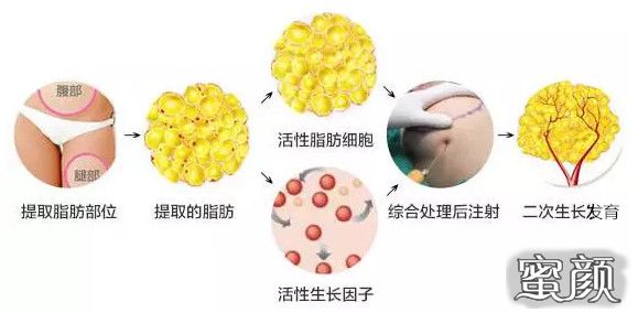 https://img.miyanlife.com/mnt/timg/210524/2154364G5-5.jpg