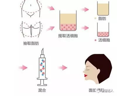 https://img.miyanlife.com/mnt/timg/210524/2155522D0-1.jpg