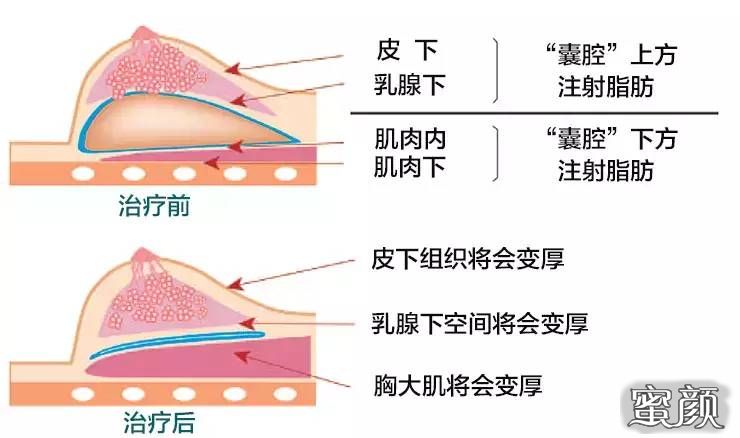 https://img.miyanlife.com/mnt/timg/210524/22025B307-3.jpg