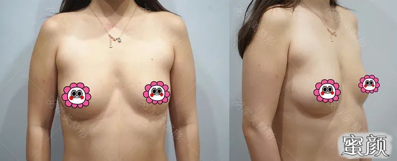 https://img.miyanlife.com/mnt/timg/210525/1K45540T-1.jpg