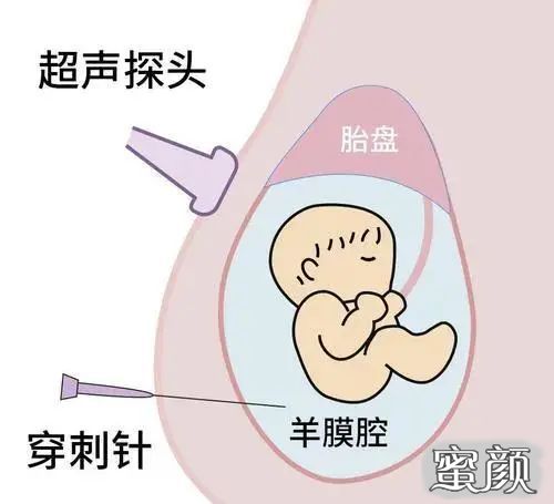 案例图片