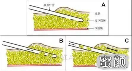 案例图片