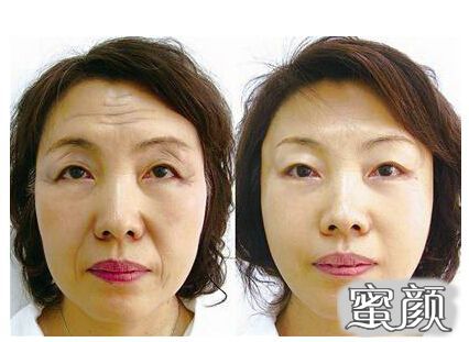 https://img.miyanlife.com/mnt/timg/210530/1231252053-2.jpg