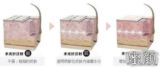 https://img.miyanlife.com/mnt/timg/210530/1553341554-1.jpg