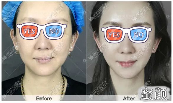 https://img.miyanlife.com/mnt/timg/210530/193531N25-2.jpg