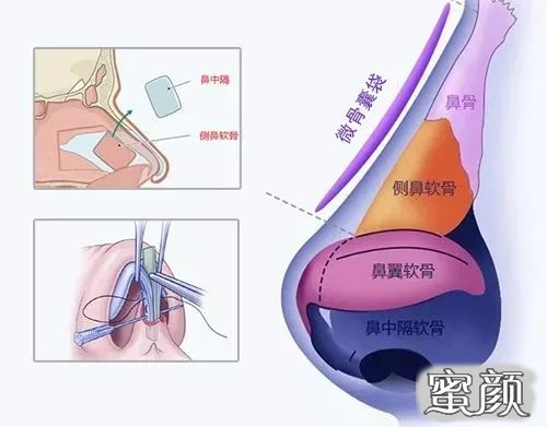 案例图片