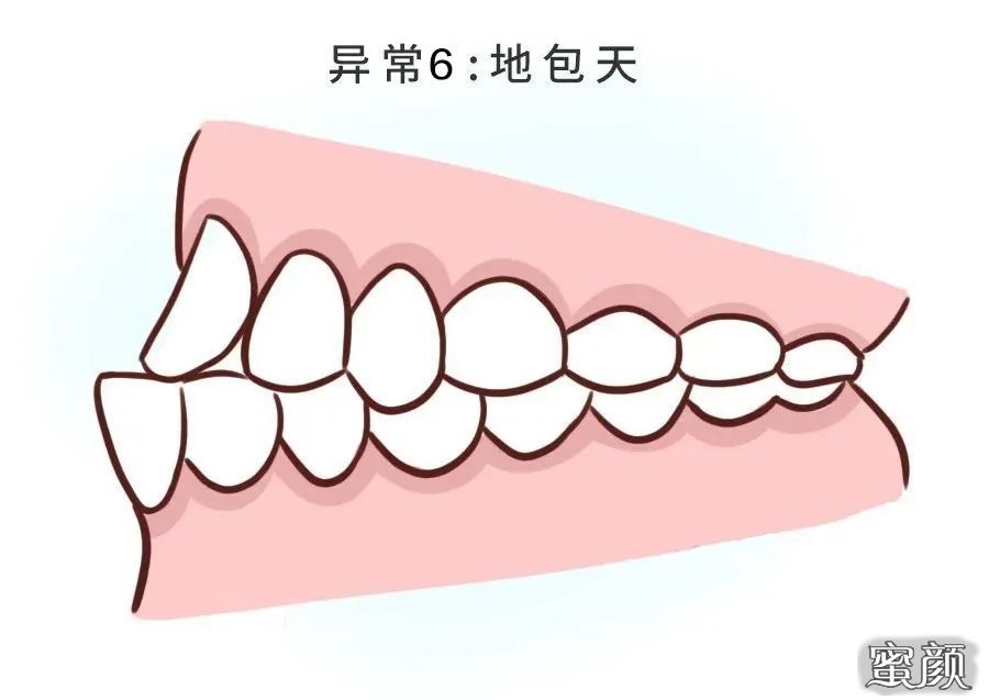 案例图片