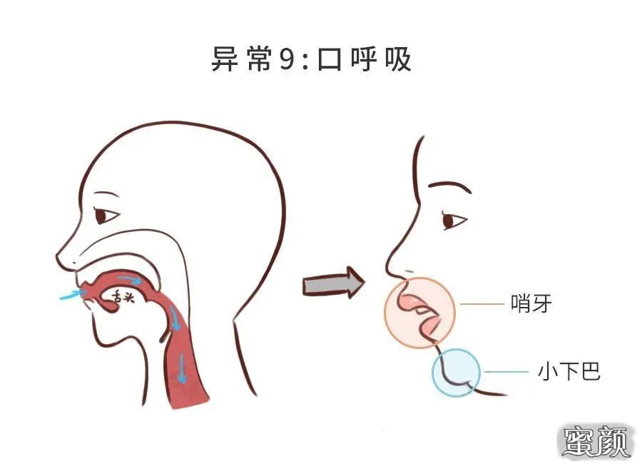 案例图片