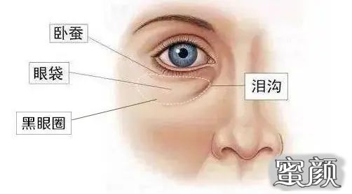 https://img.miyanlife.com/mnt/timg/210601/2330045264-0.jpg