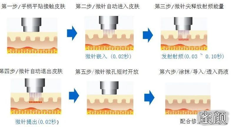 案例图片