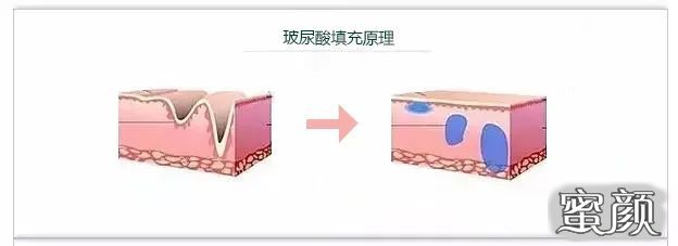 https://img.miyanlife.com/mnt/timg/210606/22201R1a-0.jpg