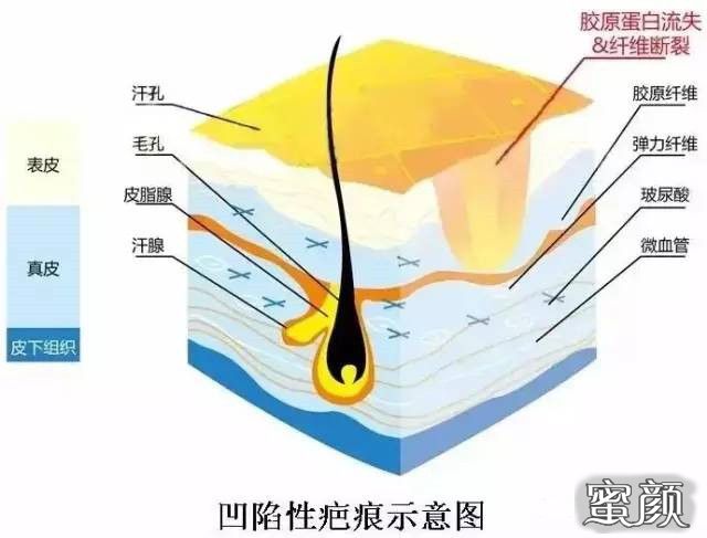 https://img.miyanlife.com/mnt/timg/210606/22201R520-1.jpg
