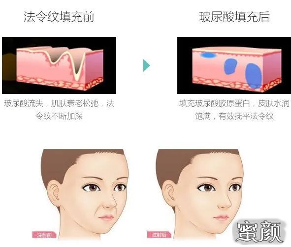 案例图片