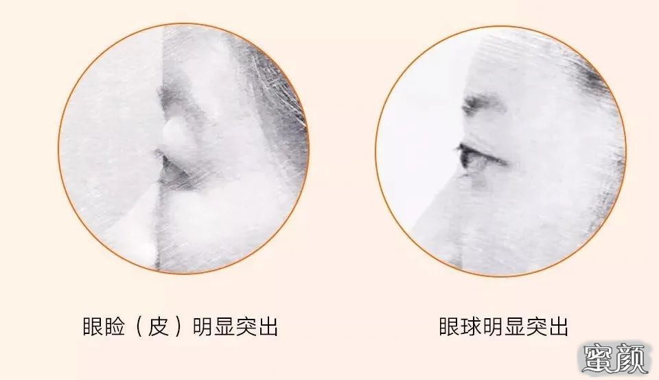 https://img.miyanlife.com/mnt/timg/210610/15003AC5-3.jpg