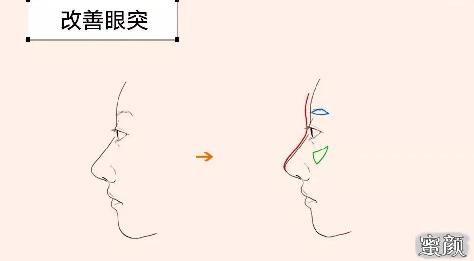 https://img.miyanlife.com/mnt/timg/210610/15003C349-4.jpg