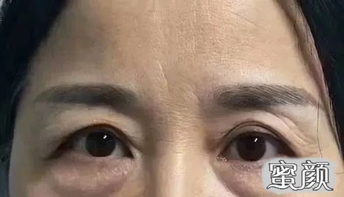 https://img.miyanlife.com/mnt/timg/210610/15003L5A-6.jpg