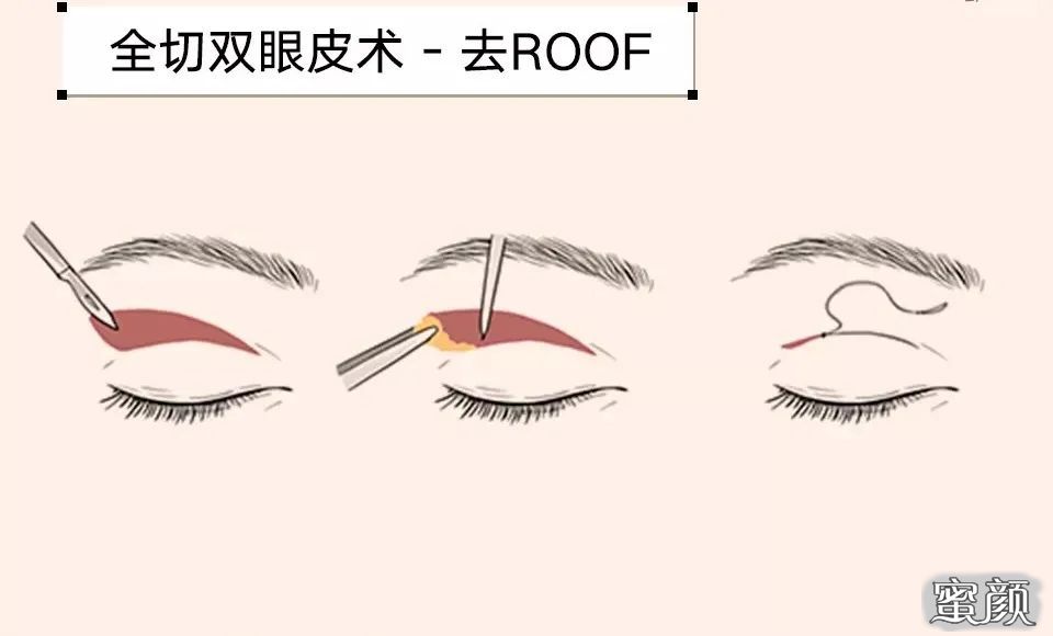 https://img.miyanlife.com/mnt/timg/210610/150040CF-11.jpg