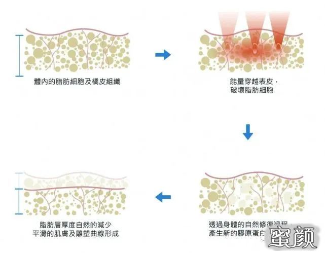 案例图片