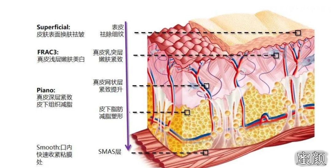 案例图片