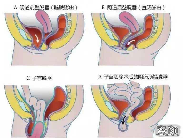 案例图片