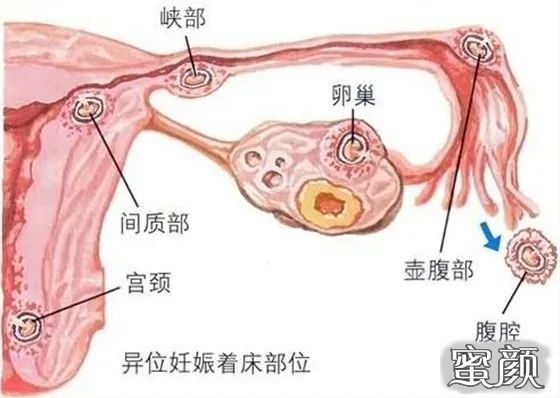 案例图片