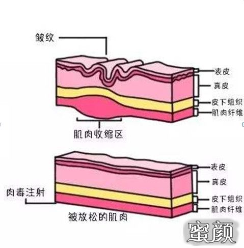 案例图片