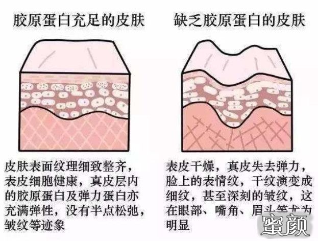 https://img.miyanlife.com/mnt/timg/210616/1304303429-4.jpg