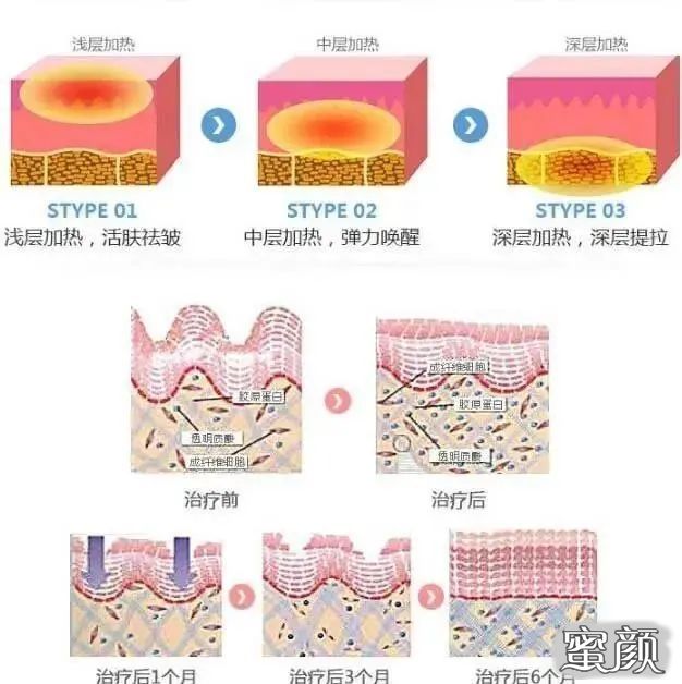 https://img.miyanlife.com/mnt/timg/210616/1S24514J-2.jpg