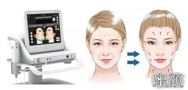 https://img.miyanlife.com/mnt/timg/210623/1PQG952-4.jpg