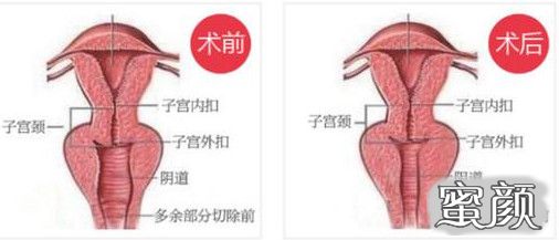 案例图片