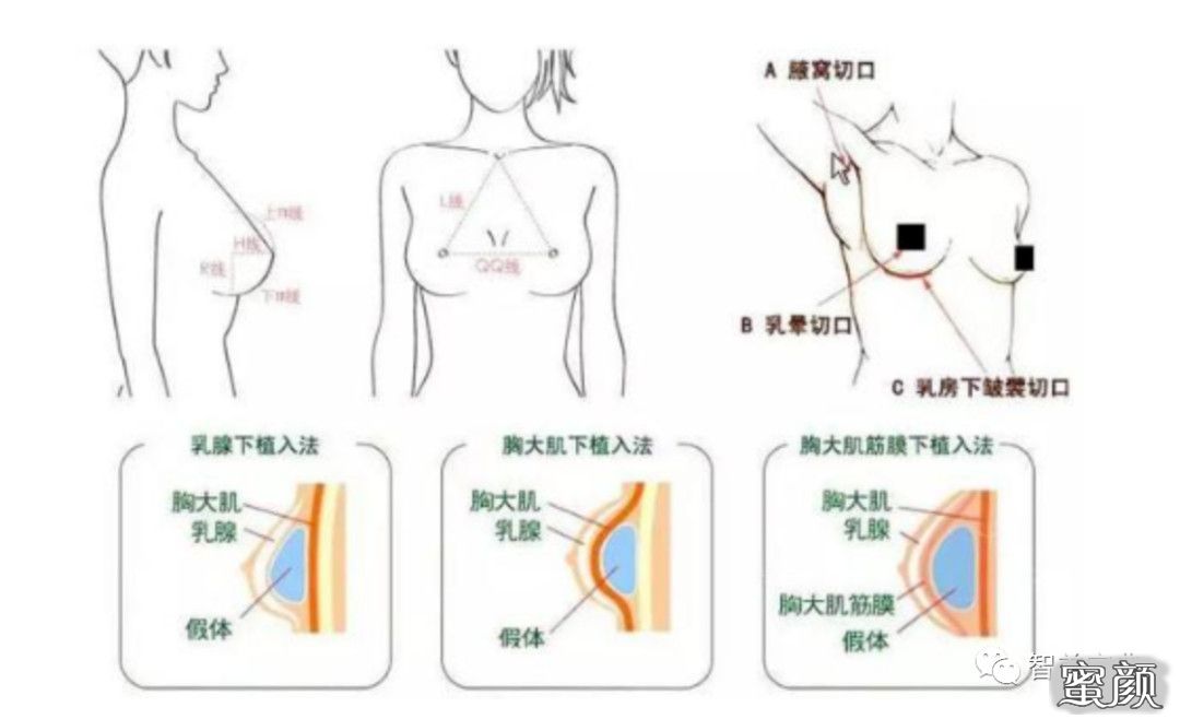 案例图片