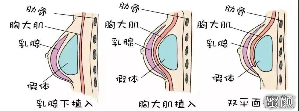 案例图片