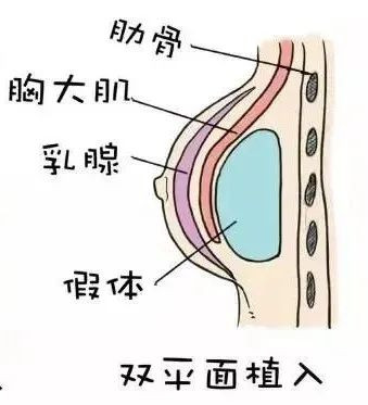 案例图片