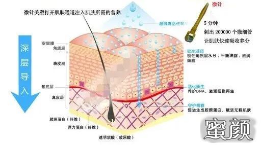 案例图片