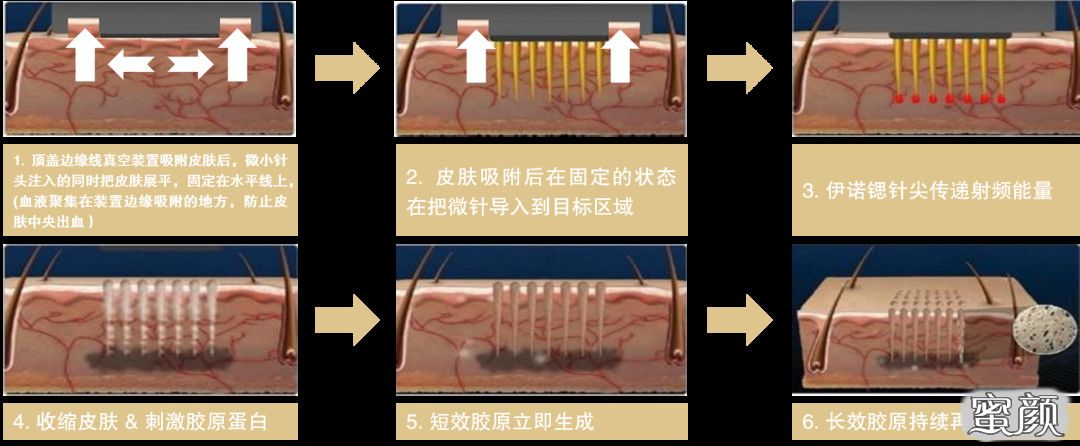 案例图片